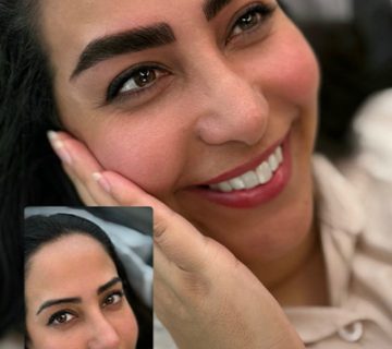 نمونه کار هاشور ابرو قبل و بعد3