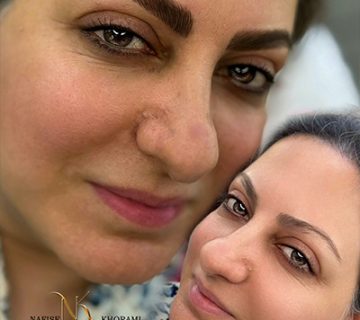 نمونه کار هاشور ابرو قبل و بعد